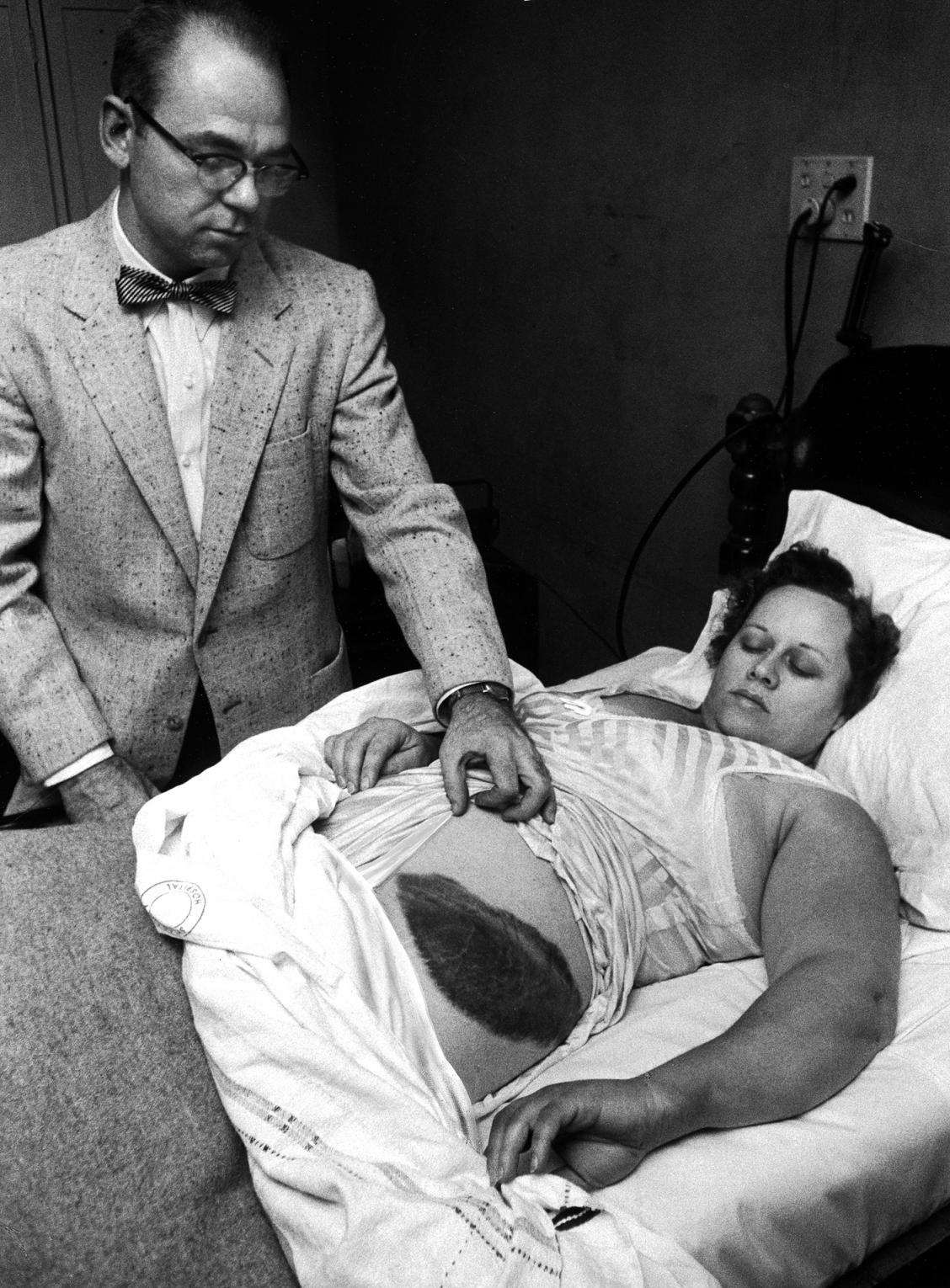 Ann Hodges struck with meteorite in 1954 in Alabama